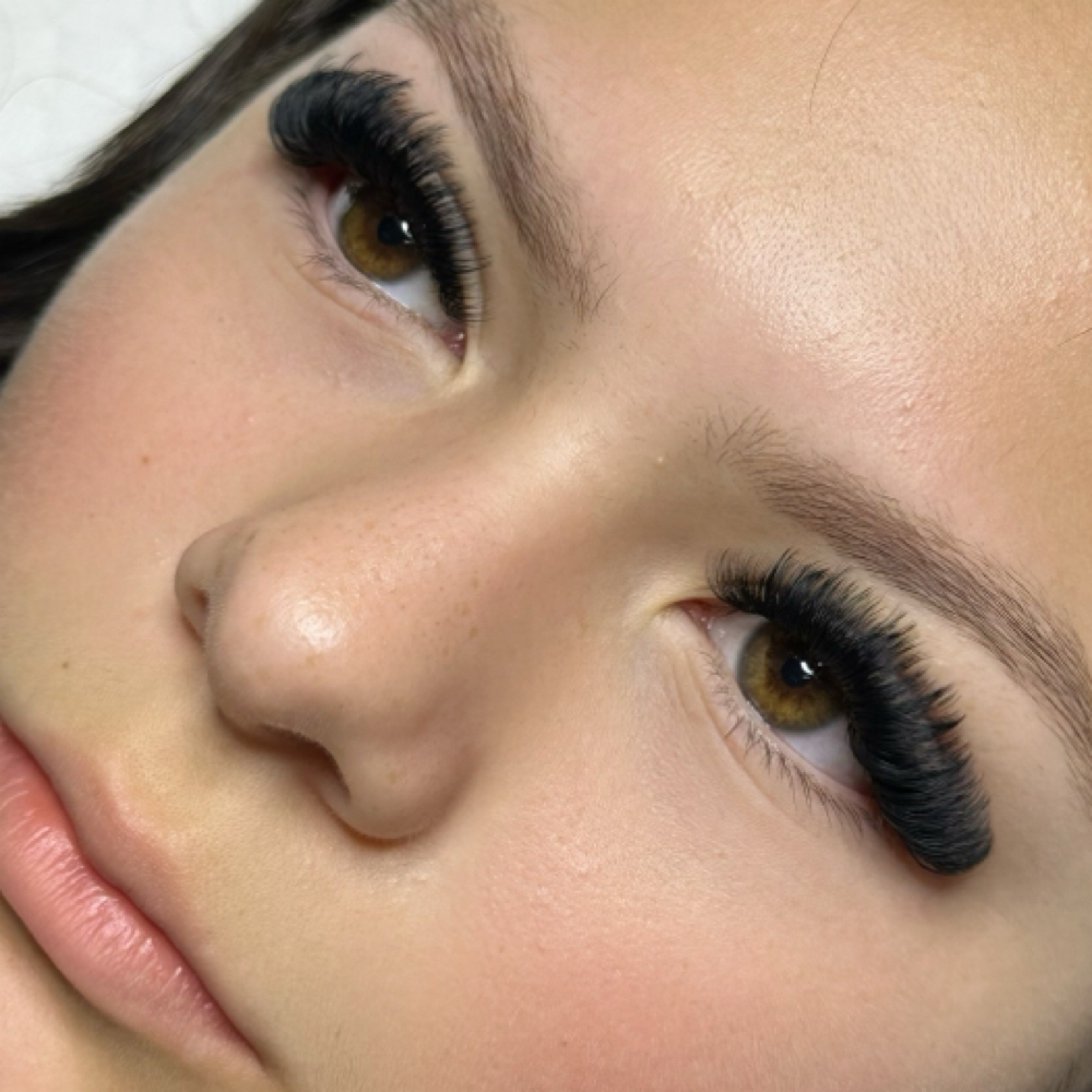 Mega 2 Week Fill at Nude Skin Aesthetics in San Pedro, CA