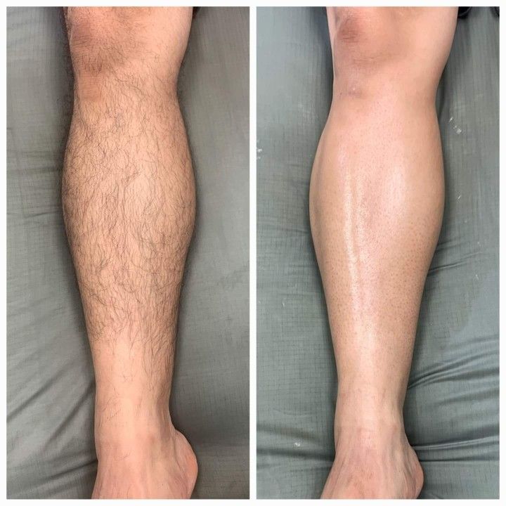 Half Legs wax at Oasis Healing Esthetics in Los Angeles, CA
