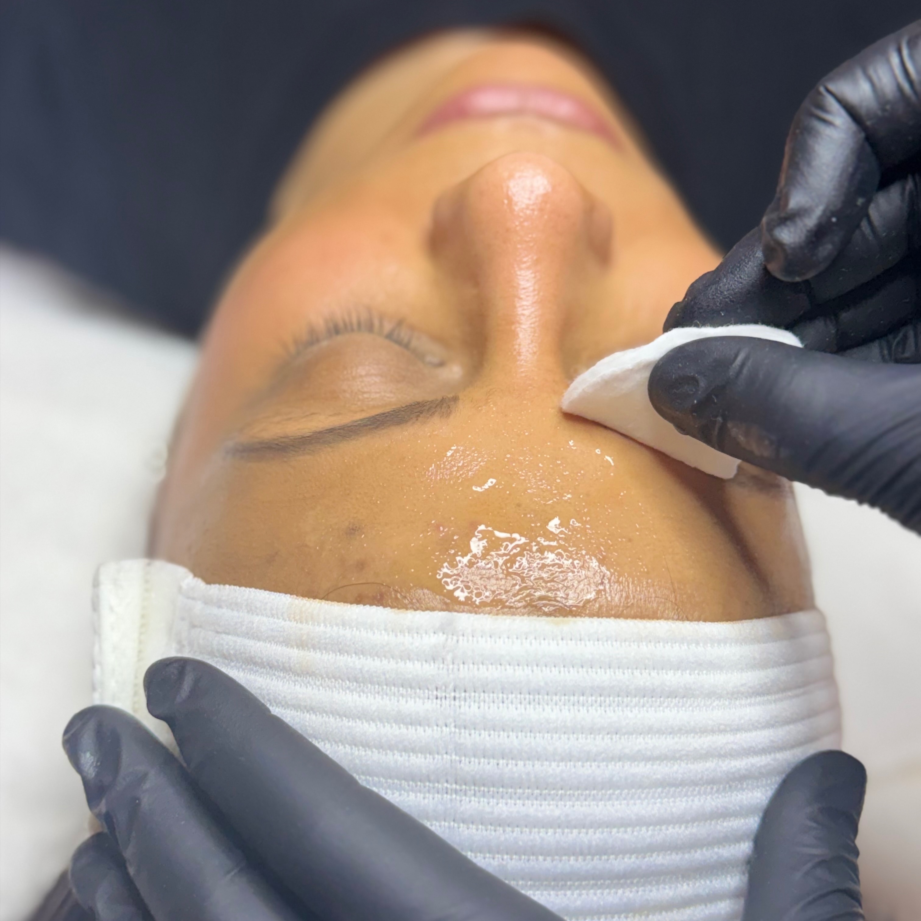Chemical Peel at Tillie's Skincare Studio in Rockland, MA