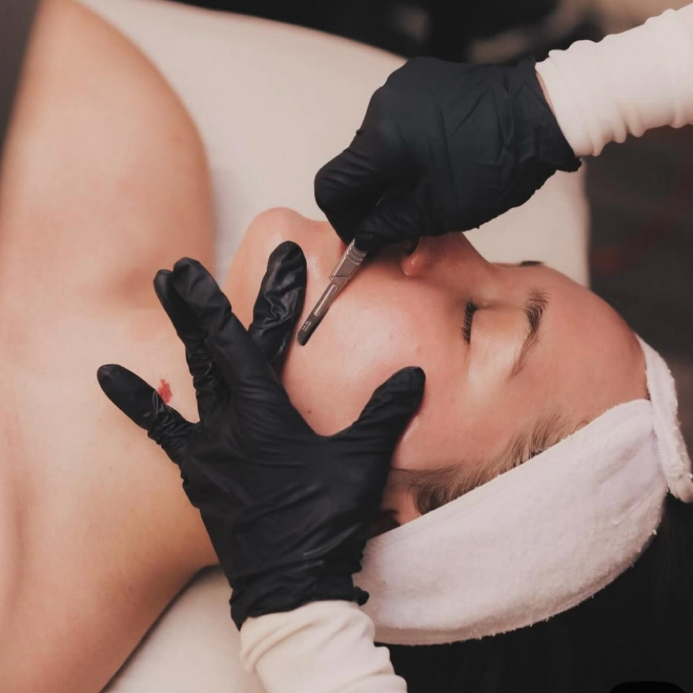 Express dermaplane at Sugar & Spice Aesthetics in Hyannis, MA