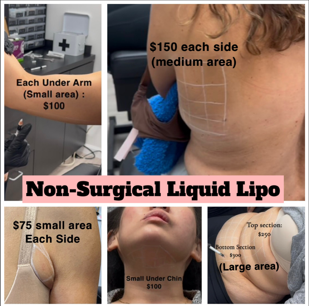 Liquid Lipo Fat Dissolve