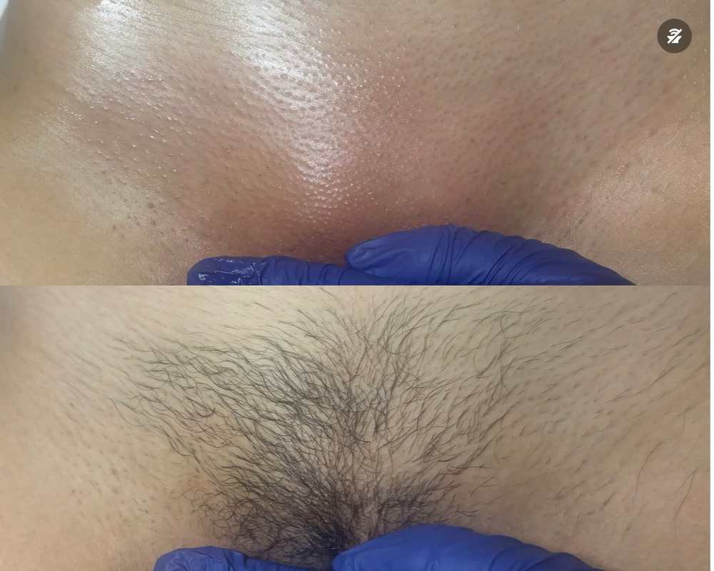 Bad & Bare Brazilian Wax at Gabriellas self care studio in Mesquite, TX