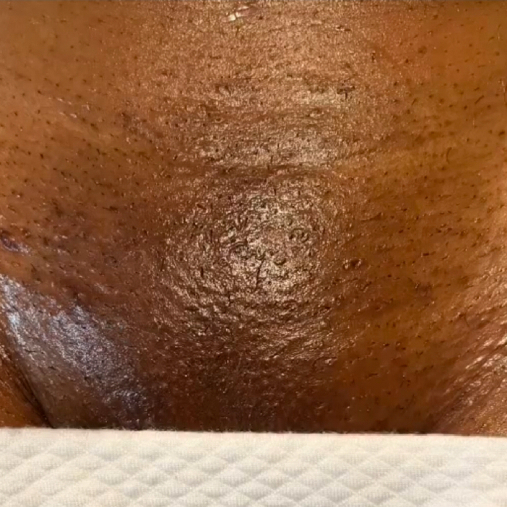 Brazilian + Underarm Bundle