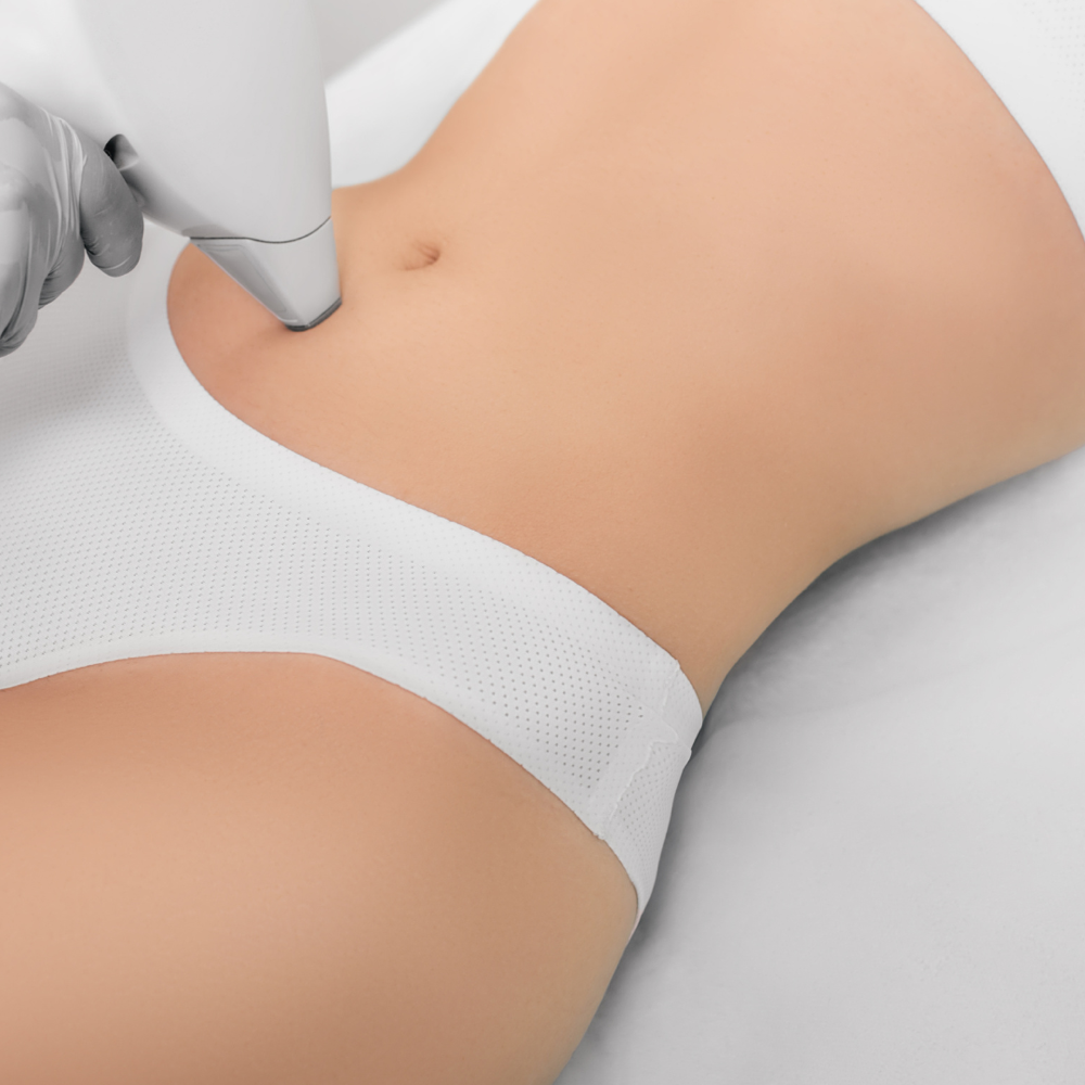 Abdomen Laser