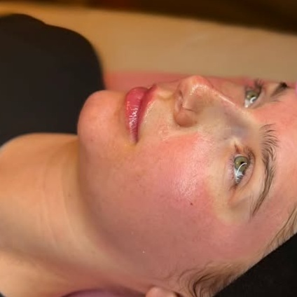 Standard Microneedling at HP Skin Bar in Durham, NC