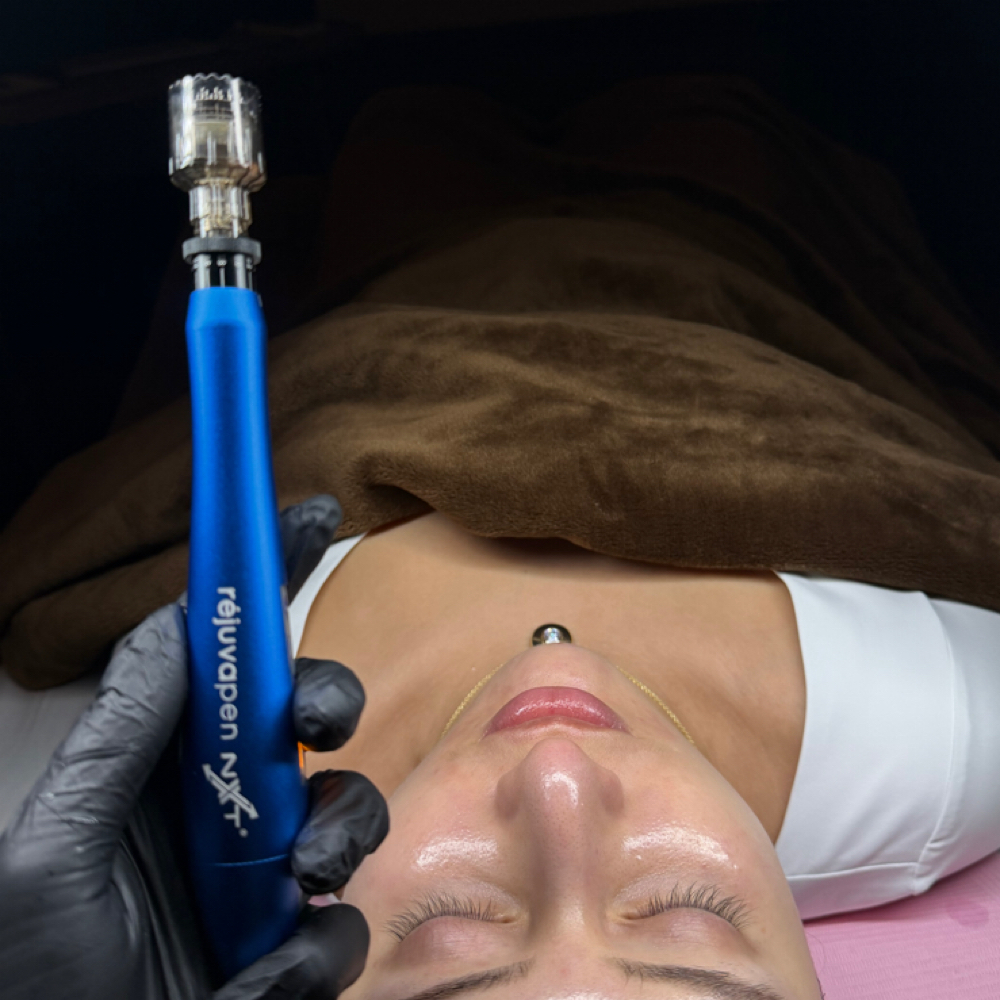 Standard Microneede at HP Skin Bar in Durham, NC