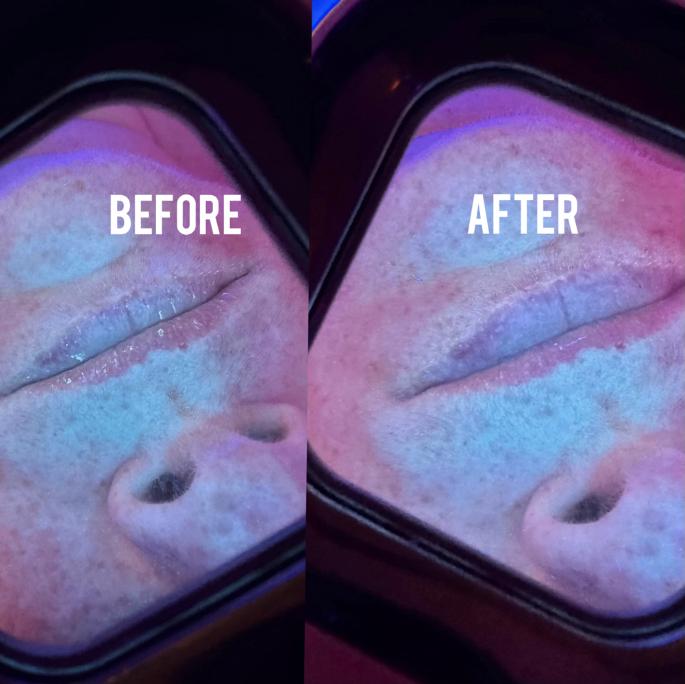ADD ON: Lip Exfoliation
