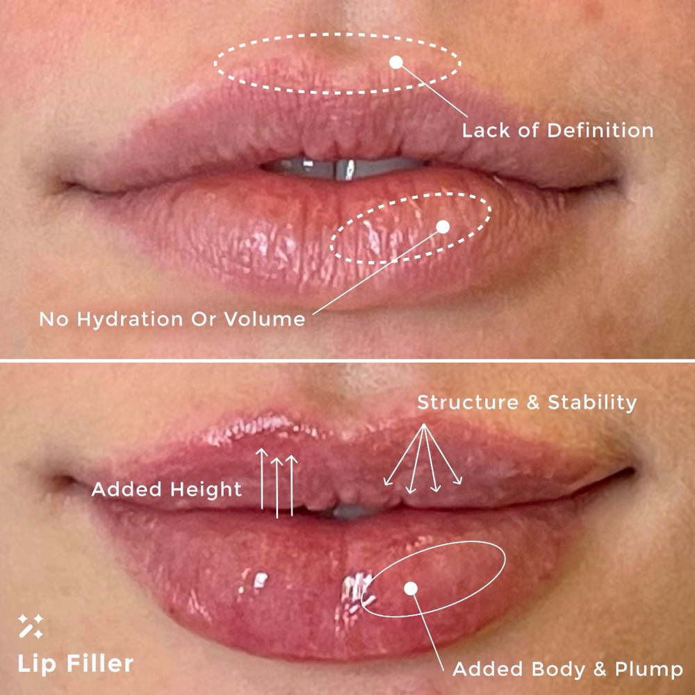 Top Off Lip Service (clients Only)