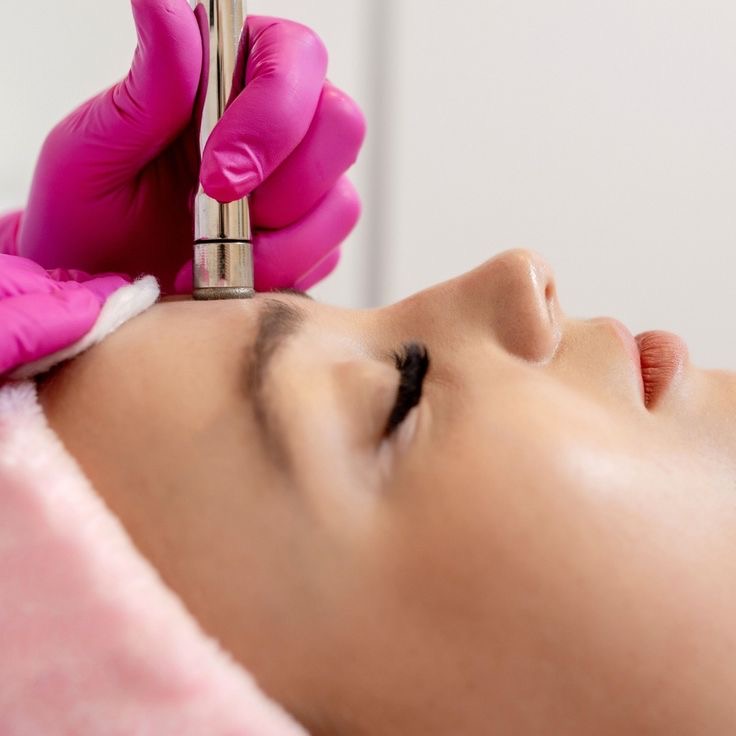 Microdermabrasion Facial