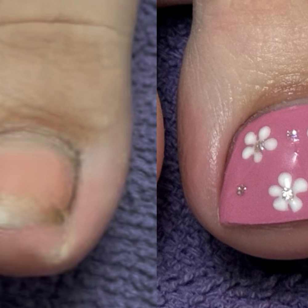 Toe BBL at The Candy Man in Apple Valley, CA