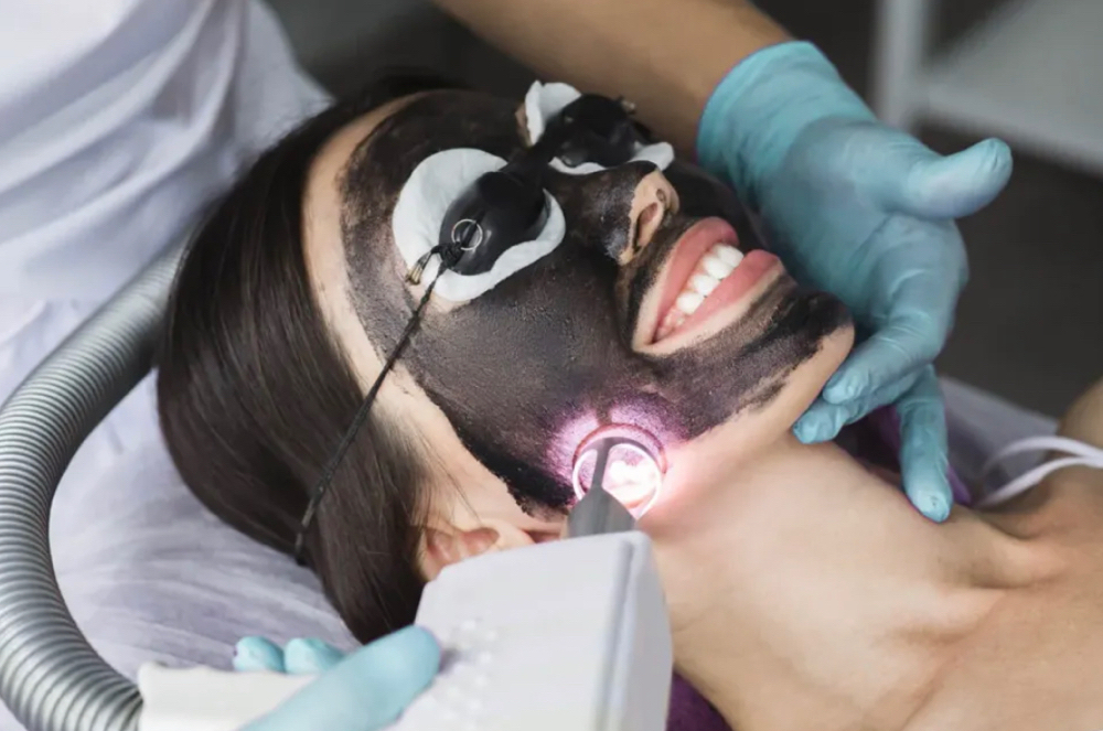Detox + Carbon Peel Laser