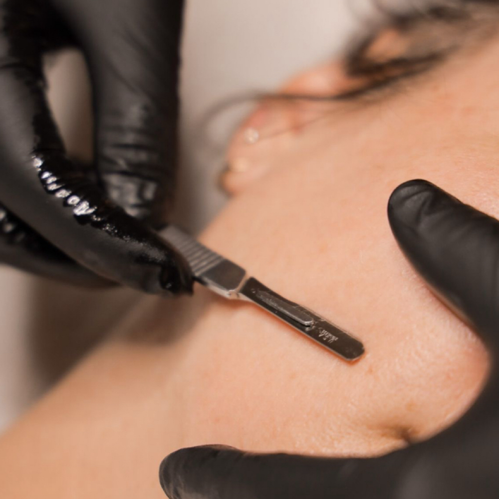 Dermaplane Enhancement at All Eyes On Me Esthetics in Billings/CutBank, MT