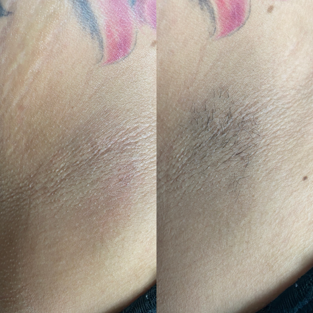 Underarm at Blooming Beauties Co. in Huntsville, AL