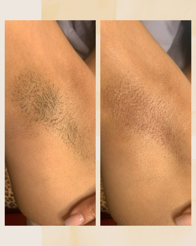 Underarm Wax