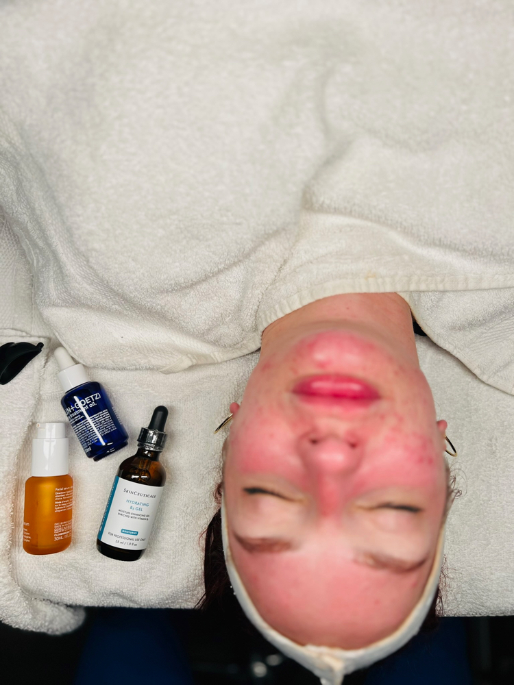 Custom Facial