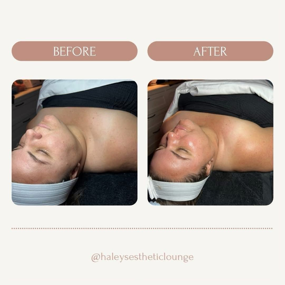 Customized Facials