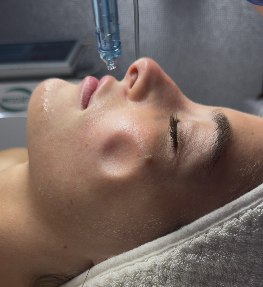 MesoJet Facial