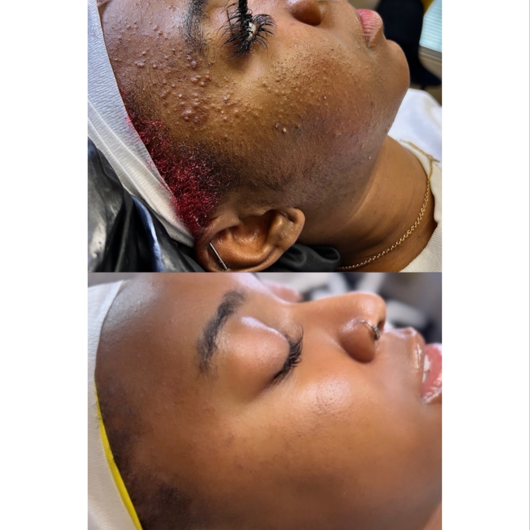 FIRMÉ CUSTOMIZED FACIAL at FIRMÉ SKIN in Columbia, MD