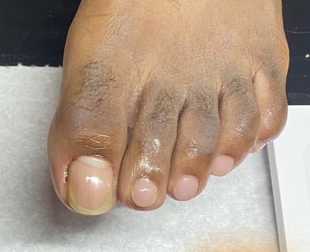 Pedicures