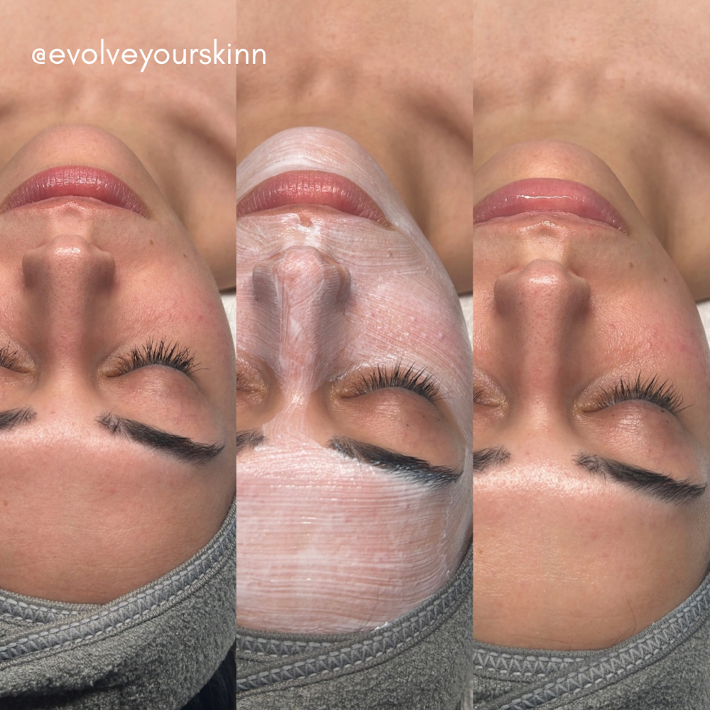 Express Facial