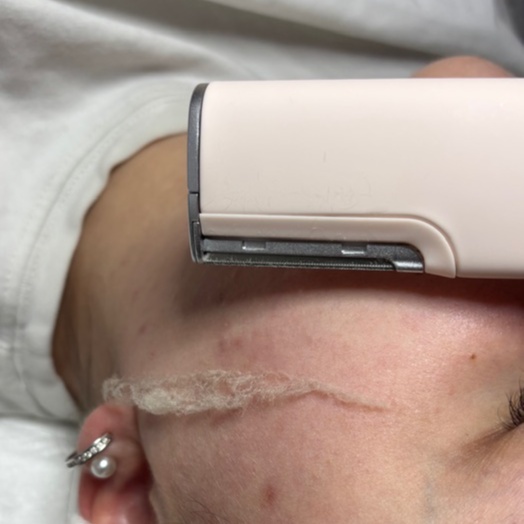 Dermaflash Add on at BK Skin & Brow Co. in Saint Charles, IL