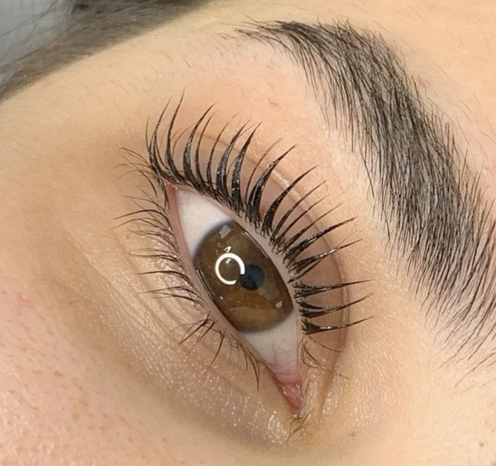 lash removal + retreatment