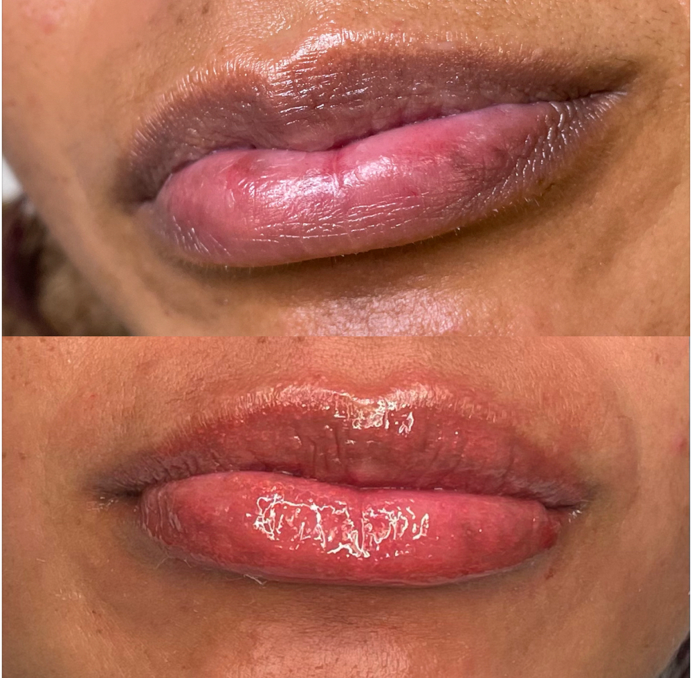 Lip Neutralization at Juanita’s Brows in Fresno, CA