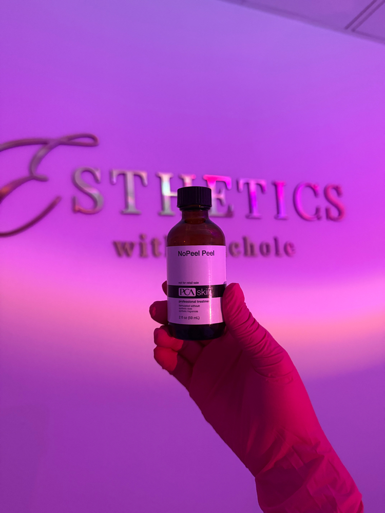 Chemical Peel