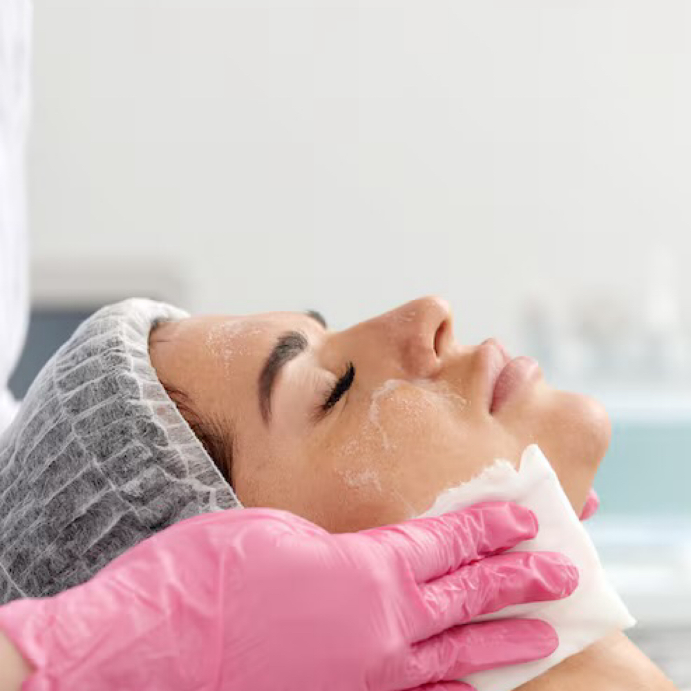 ACNE RECOVERY FACIAL at Zoraya Velez AESTHETICIAN in Richmond, VA