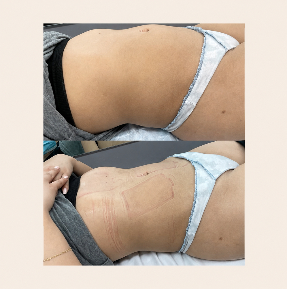 Waist Sculpt - Single Session at BODIEDBYNICKEI LLC in The Bronx, NY
