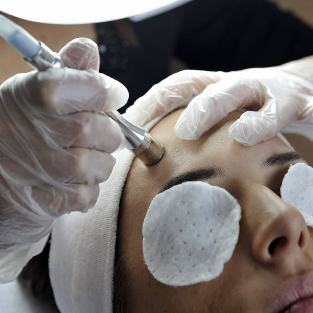 Microdermabrasion at Sol Skin Esthetics in Fort Worth, TX