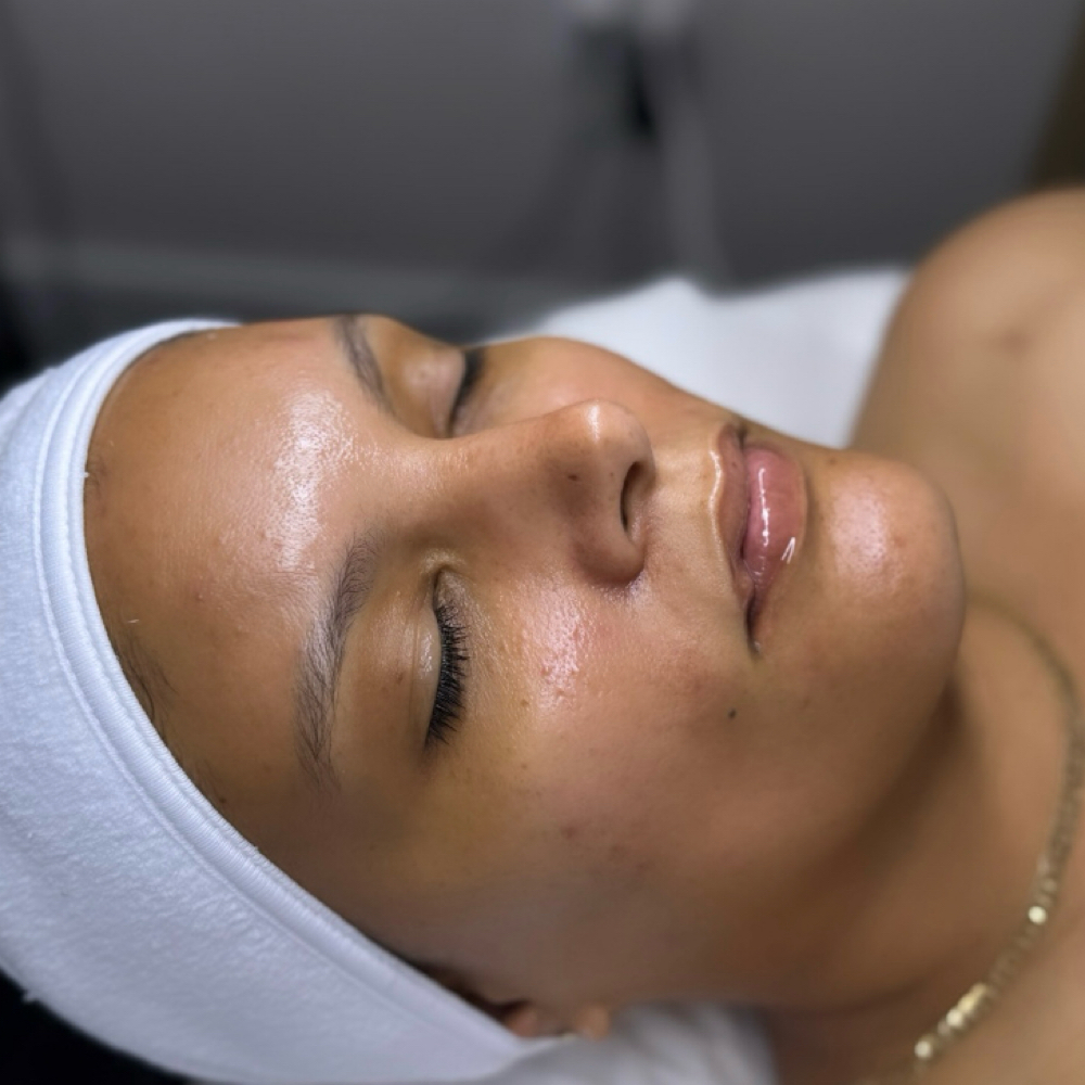 Classic Facial at Marta Rabelo Skin & Laser in Malden, MA