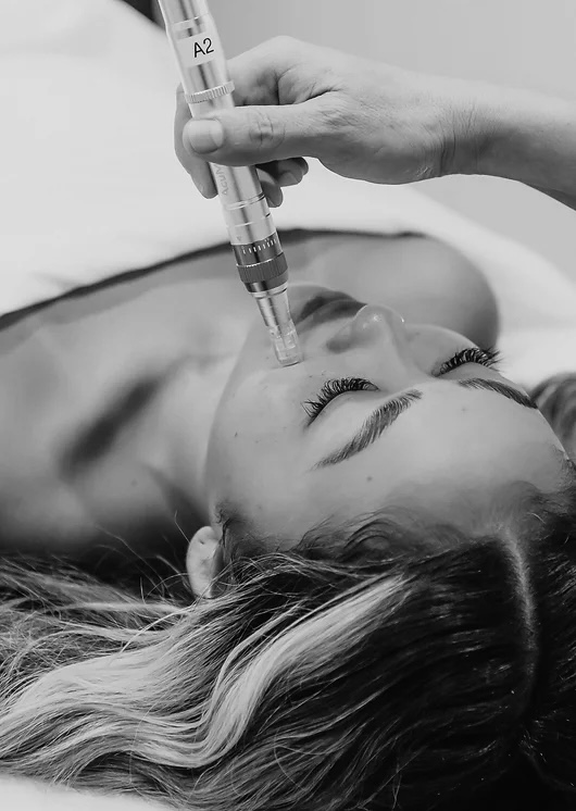 NANO-NEEDLING