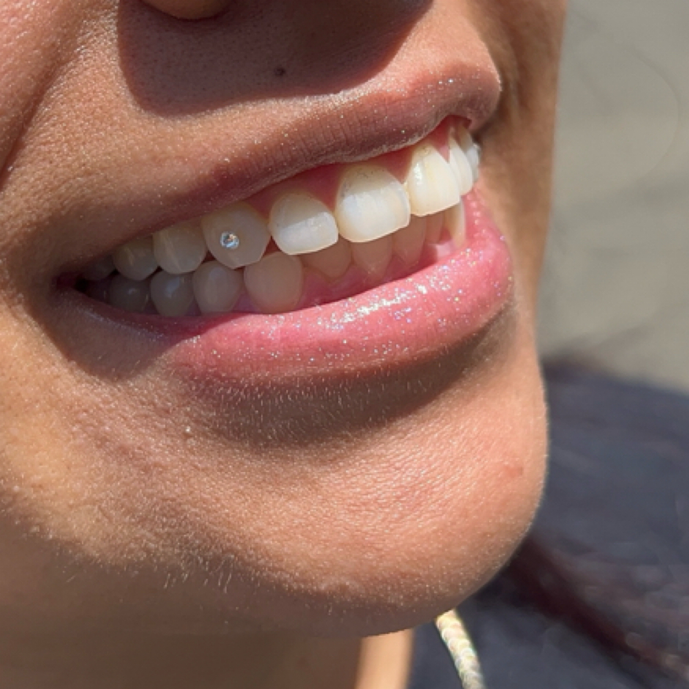 Starry Bites Tooth Gems at StarGirl Studio in Vancouver, WA