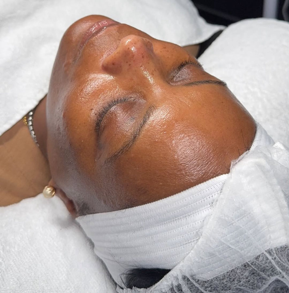 HydraFacial