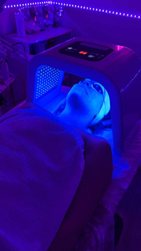 LED Light Therapy at M.A.V Aesthetics in Fort Morgan, CO