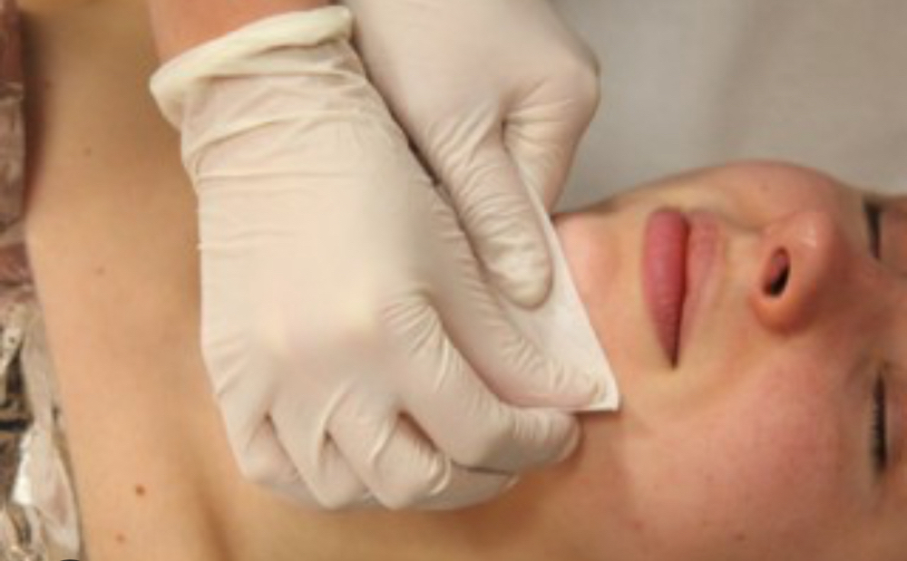 Chin wax