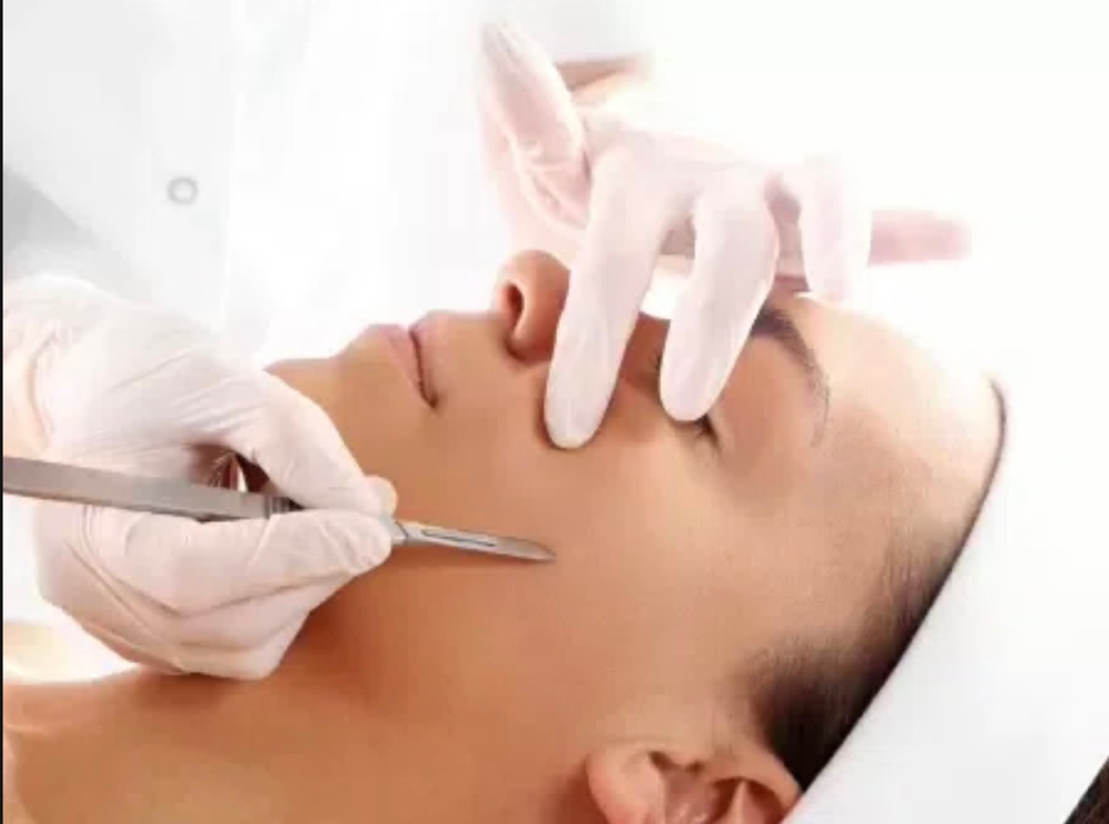 Dermaplaning Treatment