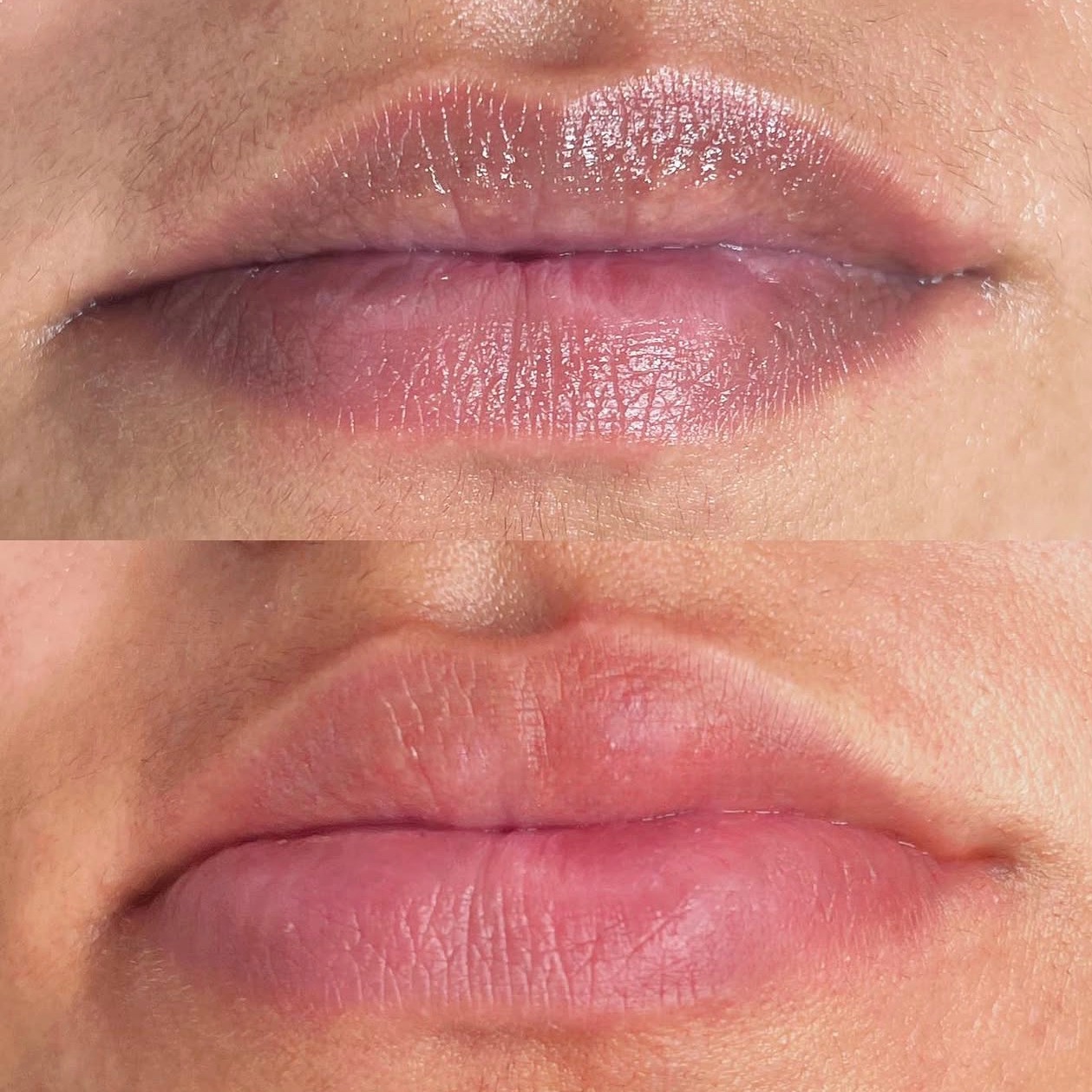 LIP TONE CORRECTION at Andressa Vadas Beauty in Newark, NJ
