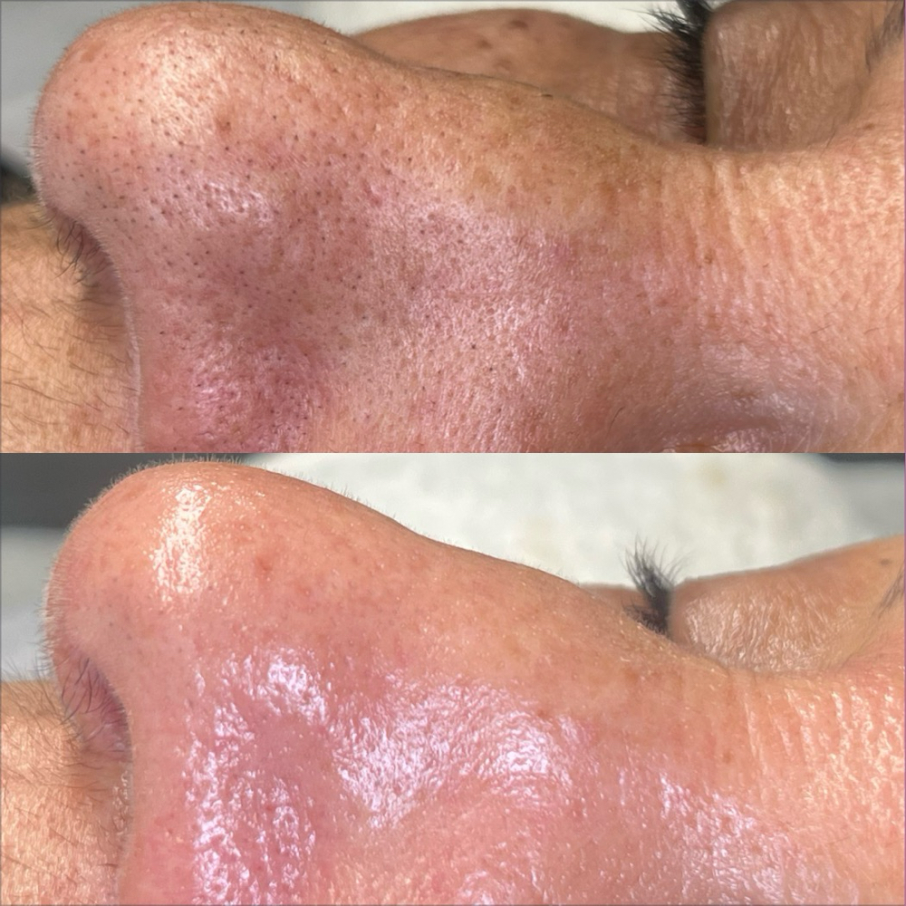 Deep Pore Cleansing Facial