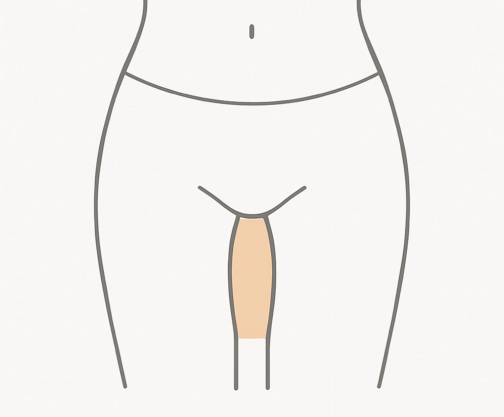 Inner Thigh at BareSkinAesthetics in Ridgeland, MS