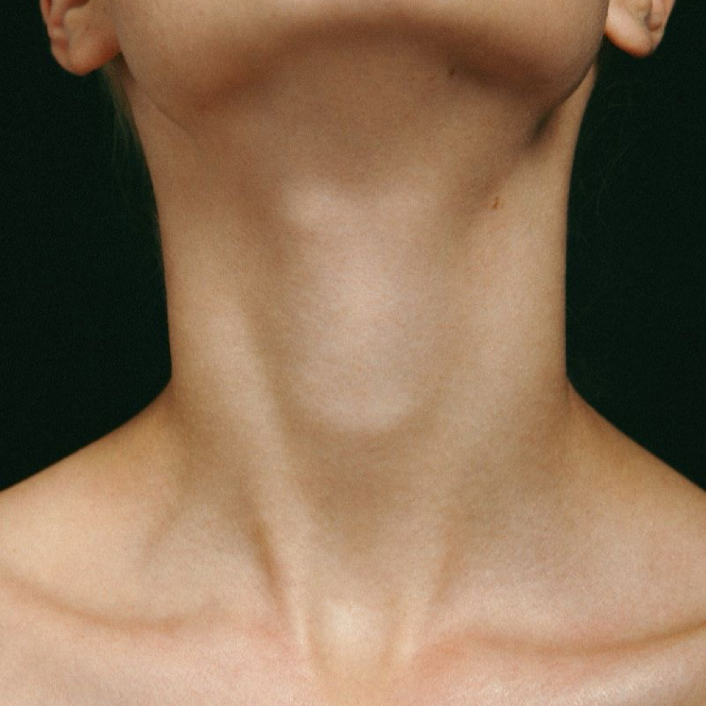 Neck Only