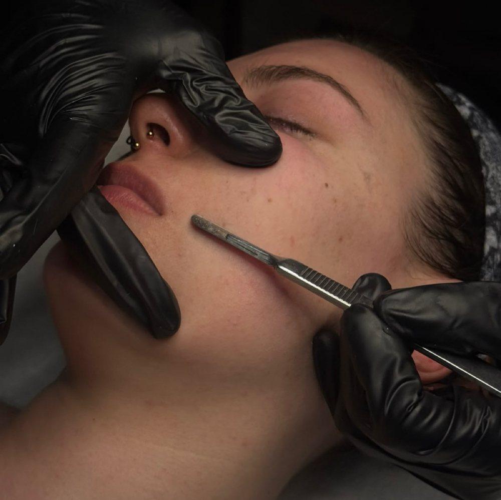 Dermaplane W/ Chemical Peel Add On at Sukoon Studio in Richardson, TX