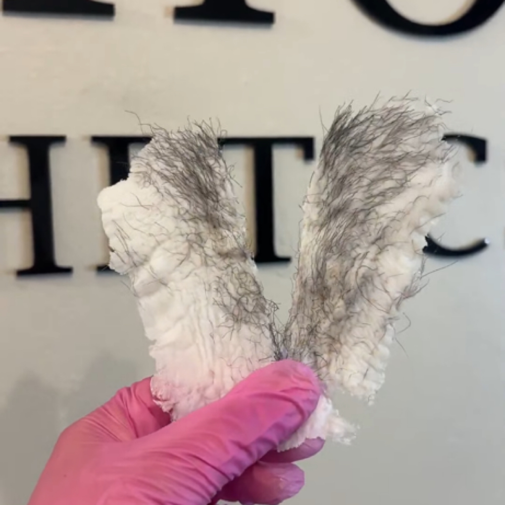 Brazilian at Windhorse Esthetics in Loveland, CO