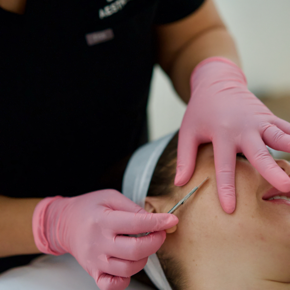 Radiance Facial (Dermaplane) at LAURA AESTHETICS in Thousand Oaks, CA