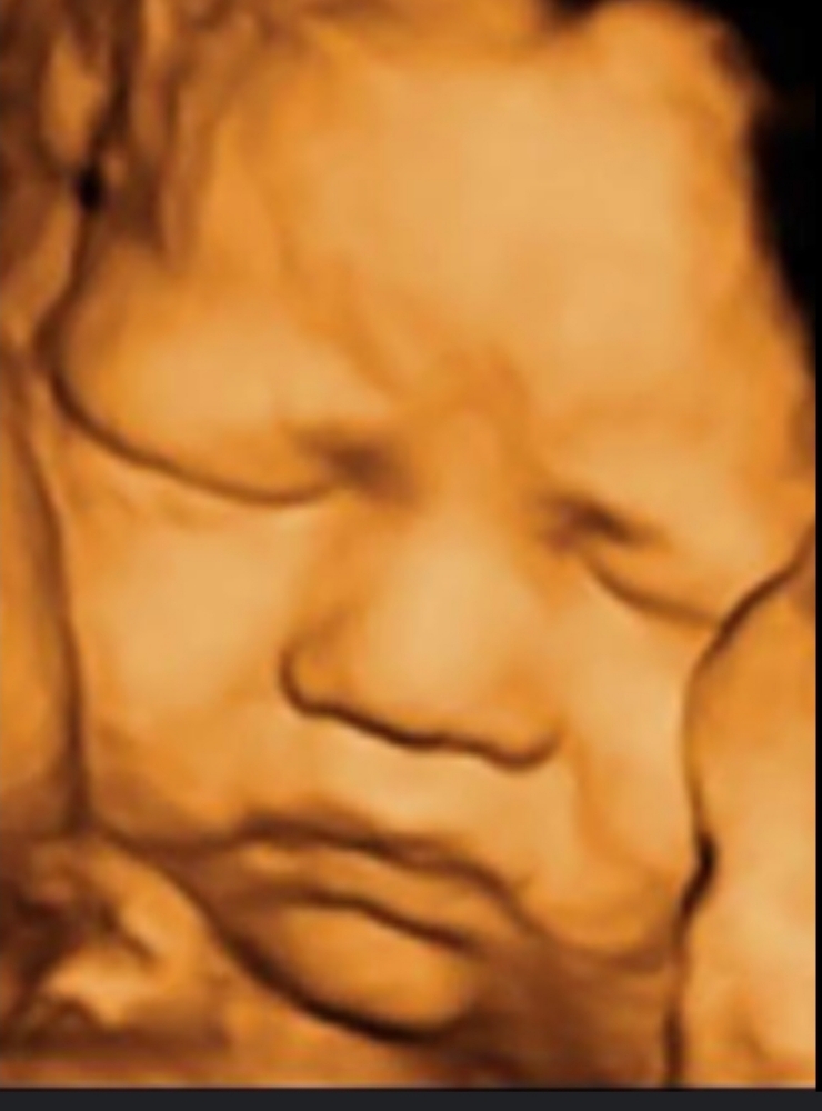 Mommy’s 3D Ultrasound