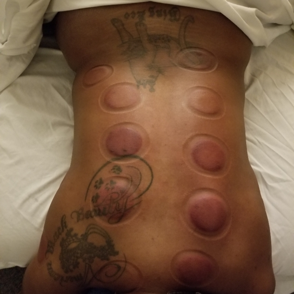 Therapeutic & Sport Therapy