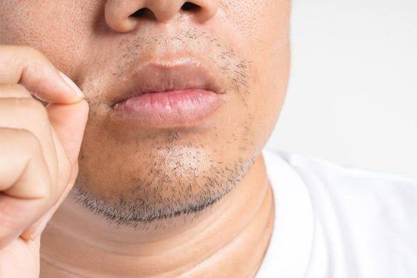 Ingrown Beard Treatment