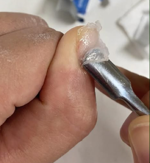 Acrylic Soak Off Overlay