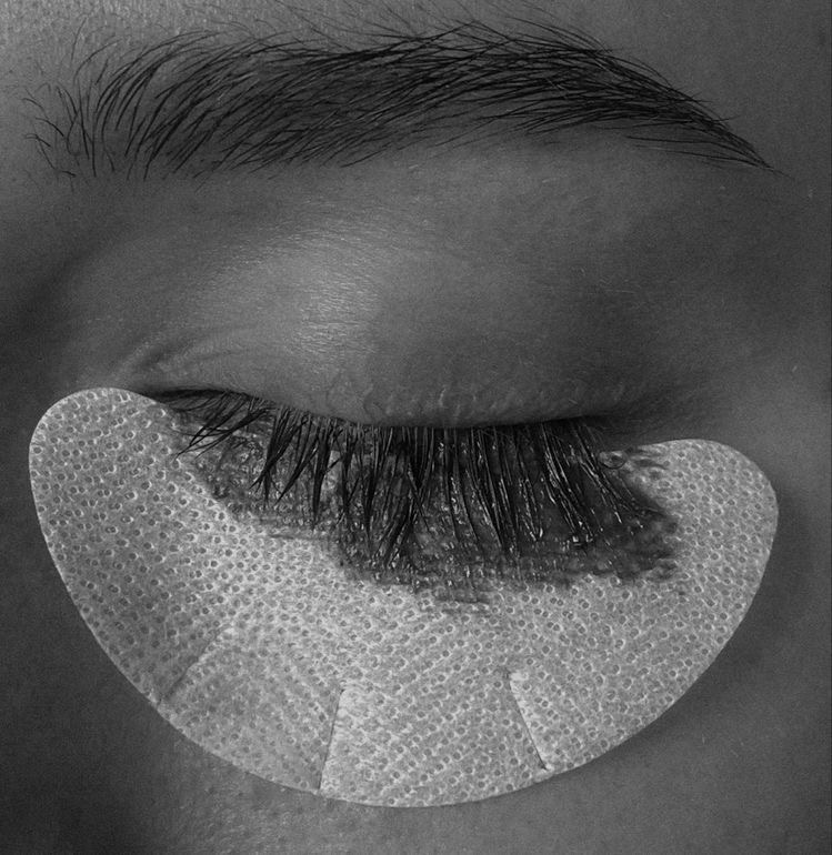Lash Removal
